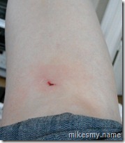 Antics alert! Kim bashed her knee against the guardrail in the Water Lilies room trying to get around the crowd blocking the entryway.